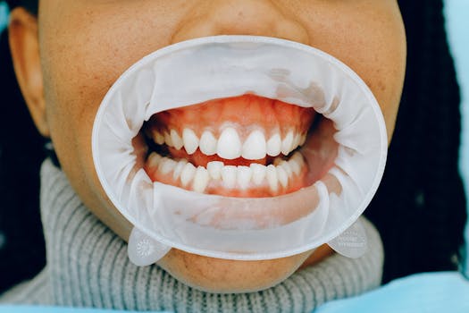 Rozluštění mýtů o ústní hygieně: Jak pečovat o zuby správně?